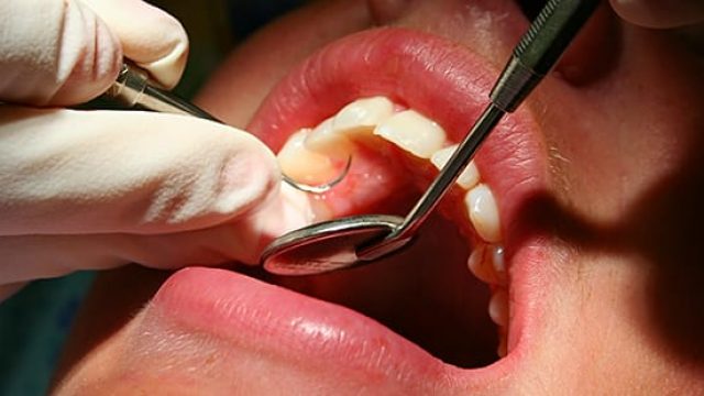 NDA calls for increased access to dental care services